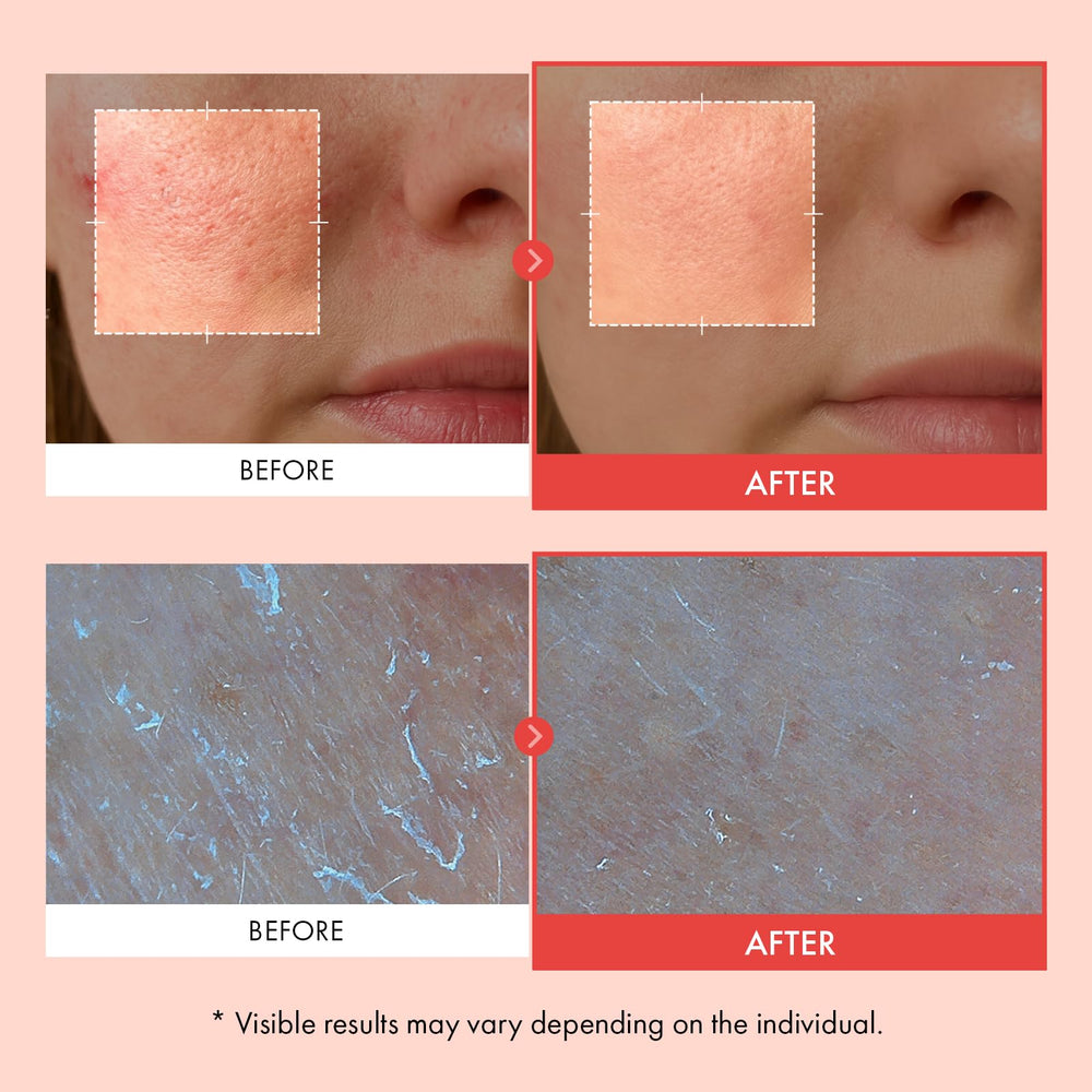 TOSOWOONG micro-spicules detail highlighting enhanced ingredient delivery