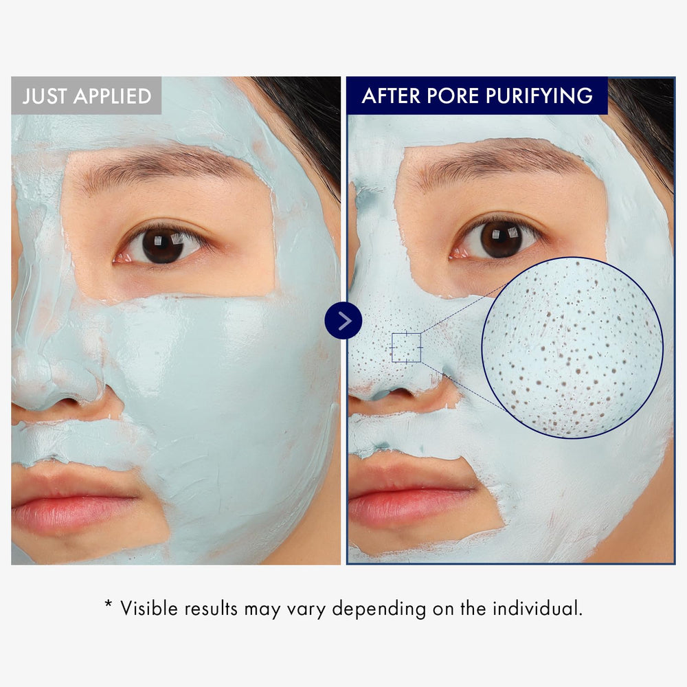TOSOWOONG mask applied to nose demonstrating targeted pore care