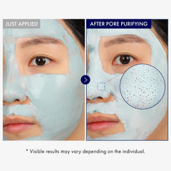 TOSOWOONG mask applied to nose demonstrating targeted pore care