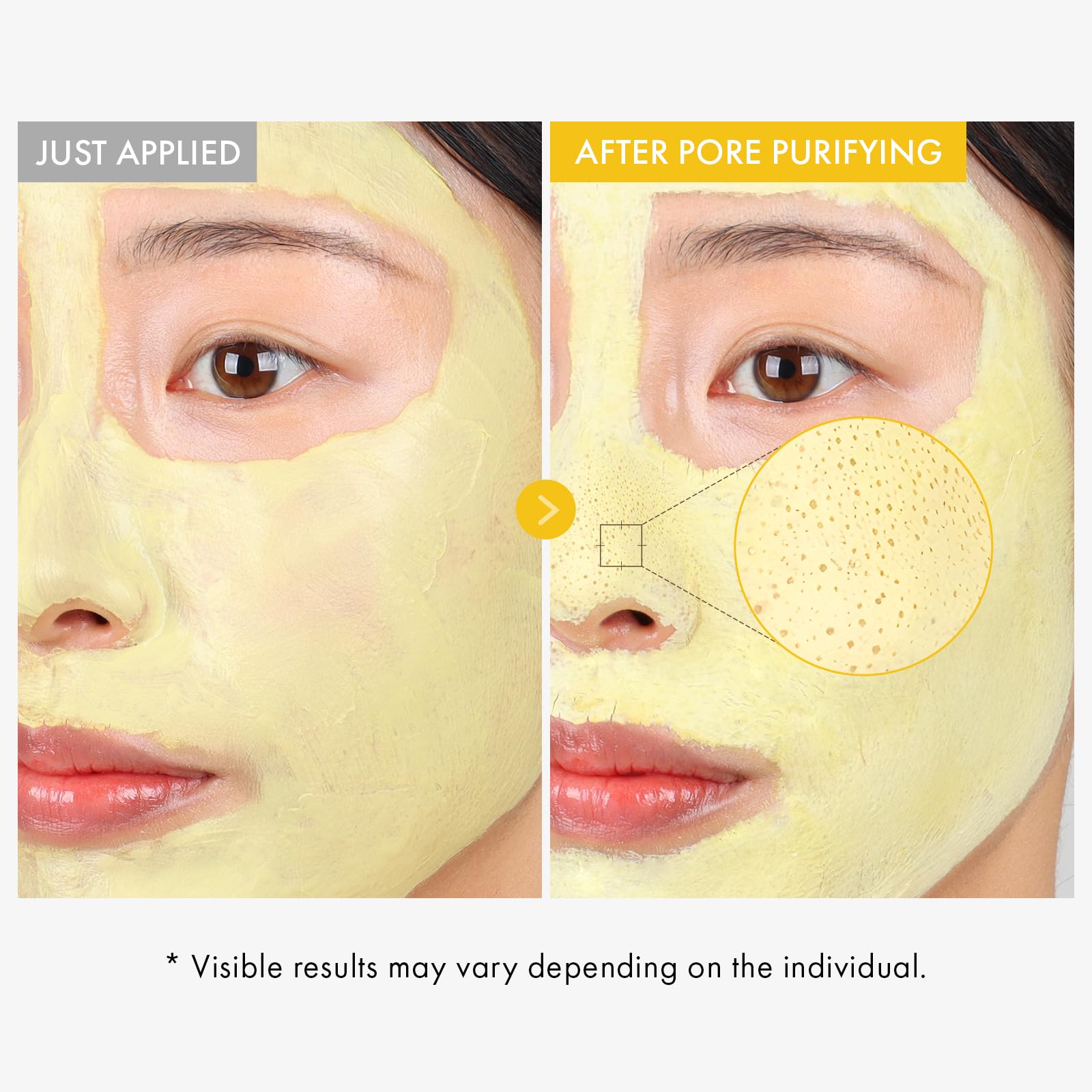 TOSOWOONG mask applied on model’s face demonstrating cooling, pore-clearing use