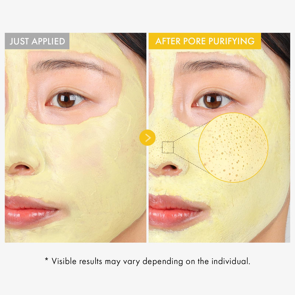 TOSOWOONG mask applied on model’s face demonstrating cooling, pore-clearing use