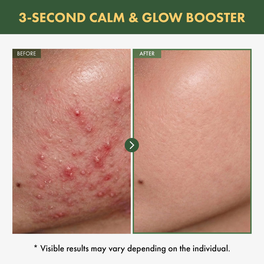 TOSOWOONG serum texture drop close-up highlighting watery hydration and fast absorption benefit