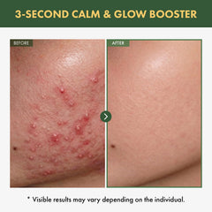 TOSOWOONG serum texture drop close-up highlighting watery hydration and fast absorption benefit