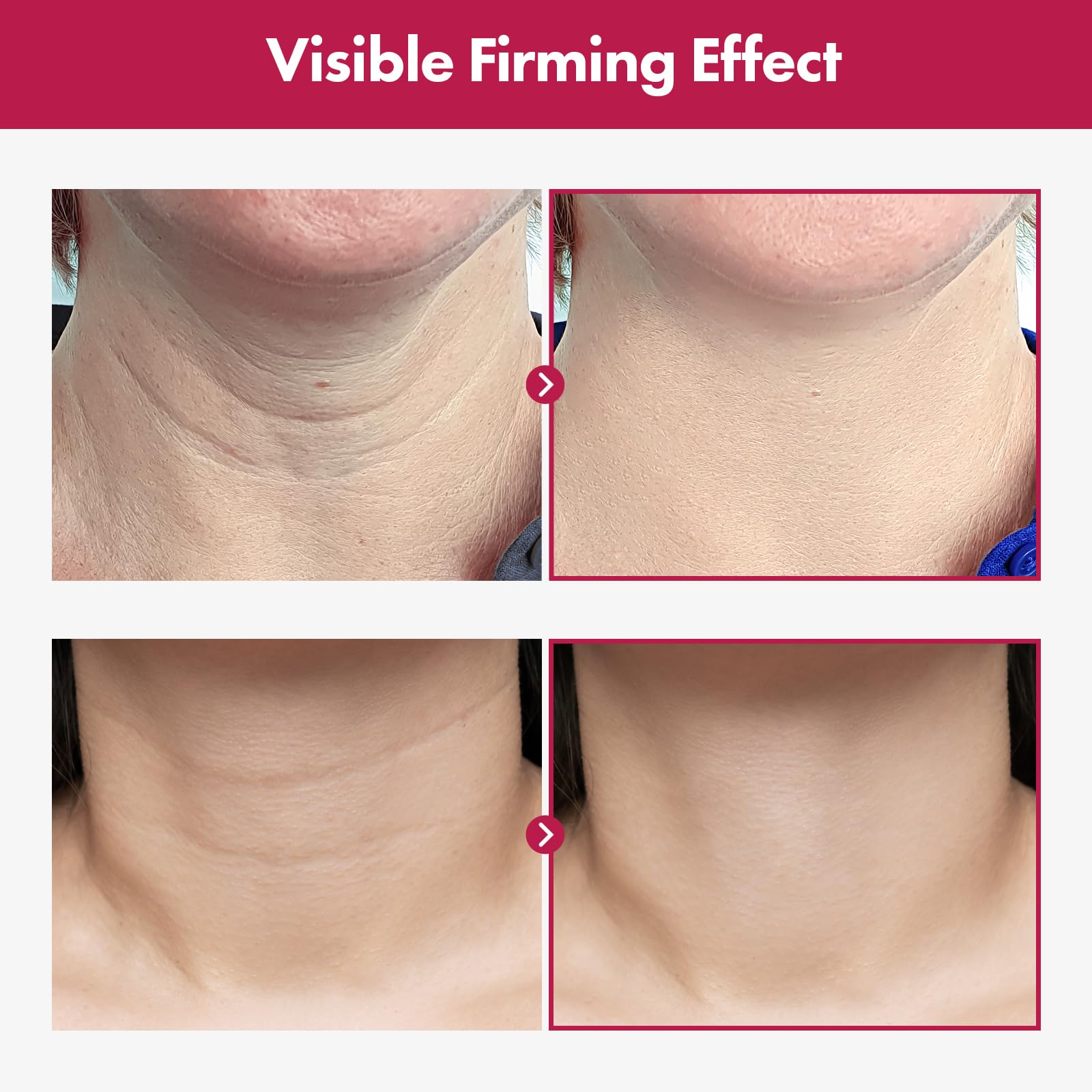 TOSOWOONG Necktox Cream application motion demonstrates quick absorption and non-sticky finish