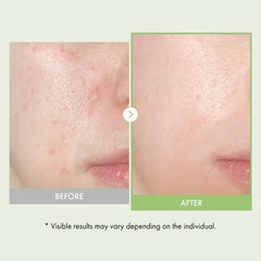 TOSOWOONG glossy ampoule drop texture delivering hydration