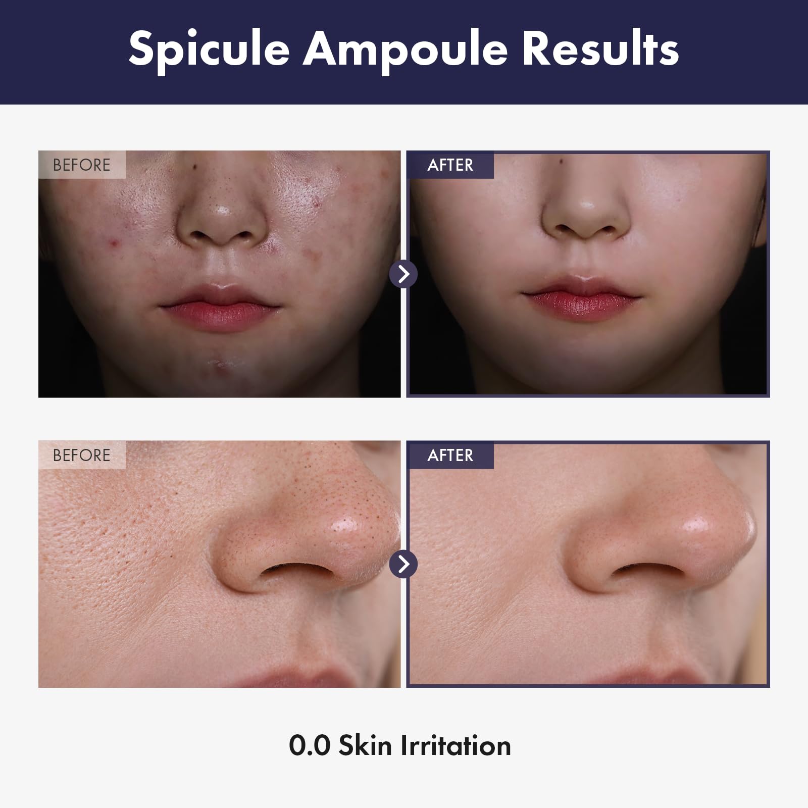 TOSOWOONG open dropper close-up showing serum texture for easier absorption