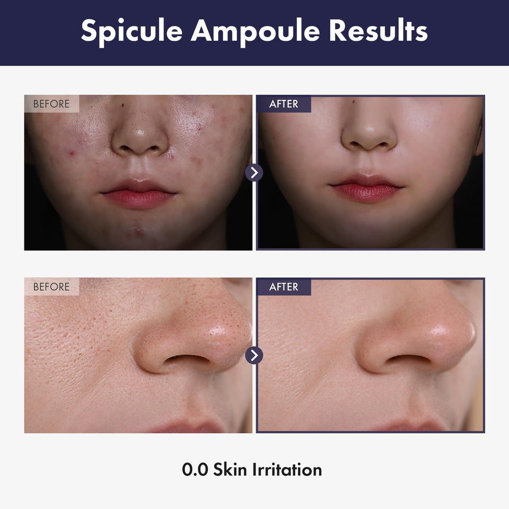 TOSOWOONG open dropper close-up showing serum texture for easier absorption