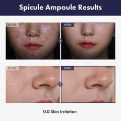 TOSOWOONG open dropper close-up showing serum texture for easier absorption