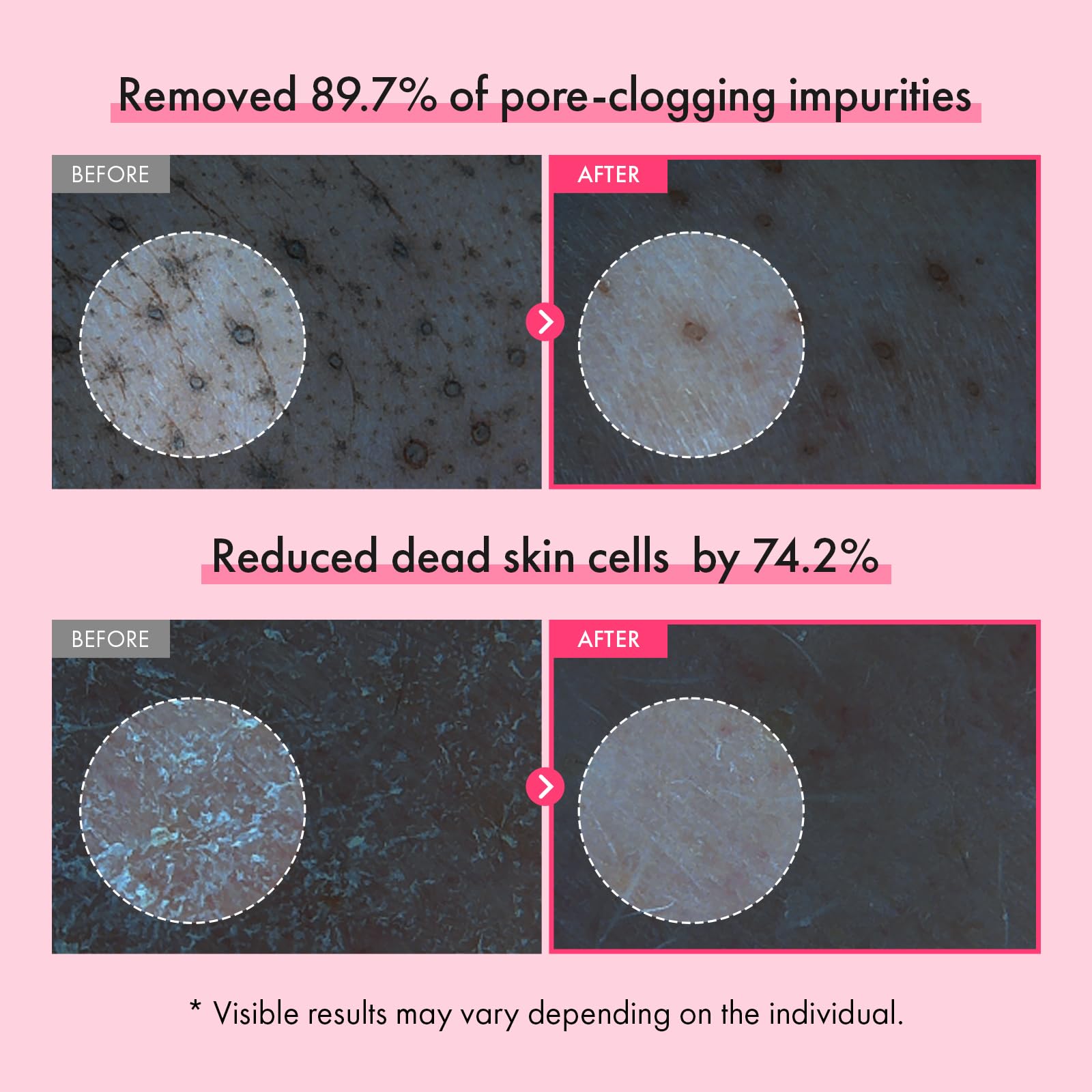 TOSOWOONG pink capsules dissolving in foam showing deep-clean action
