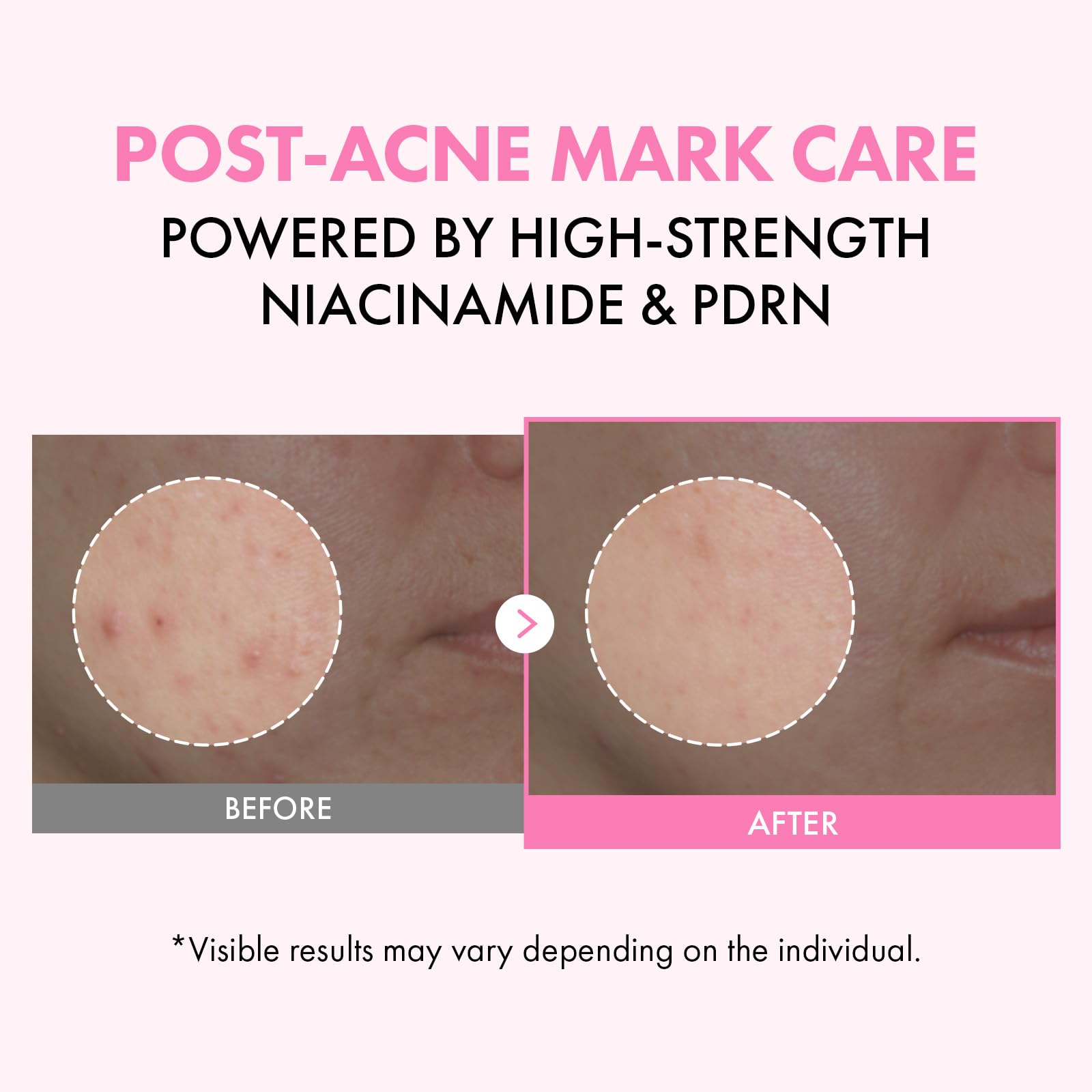 Close-up of pink milky texture highlighting TOSOWOONG hydration effect