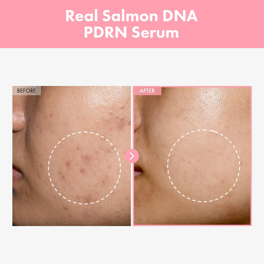 TOSOWOONG pink peptide 12 PDRN serum packaging conveys premium hydration and glow.