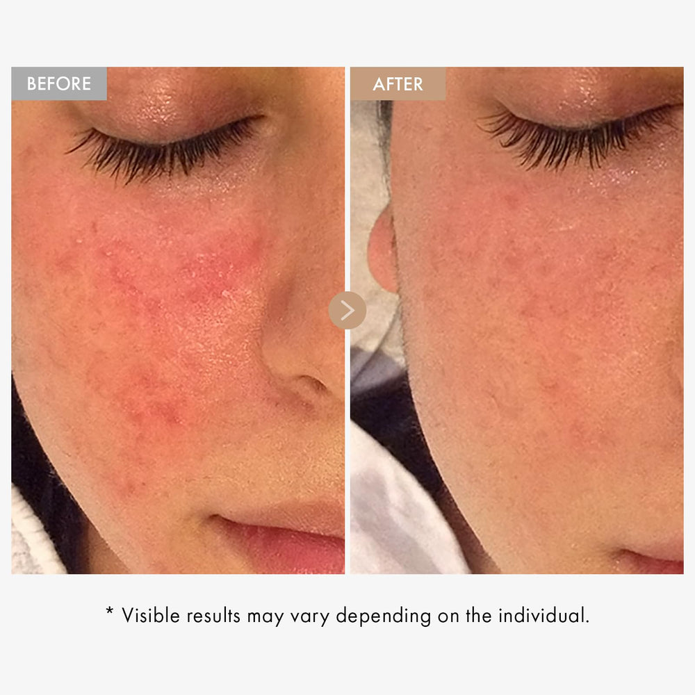 TOSOWOONG Real Oatmeal Relief Cream ingredient swirl highlights oat-based calming complex.