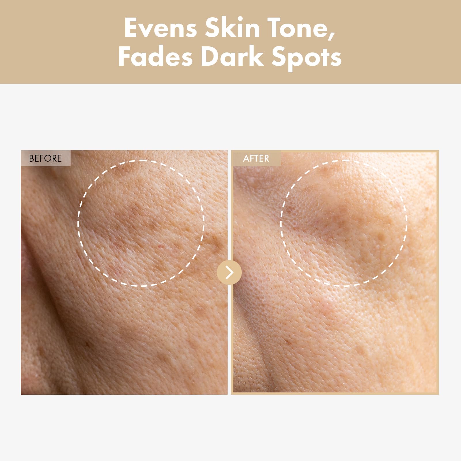 TOSOWOONG Rice Glow Milky Toner milky texture swirls into skin for instant hydration.