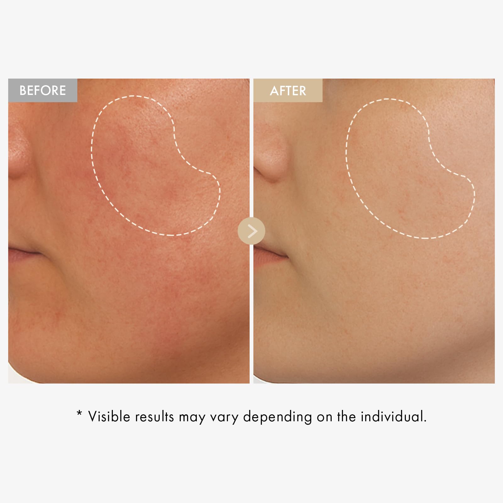 TOSOWOONG serum dropper dispensing texture, demonstrates fast absorbing hydration benefit