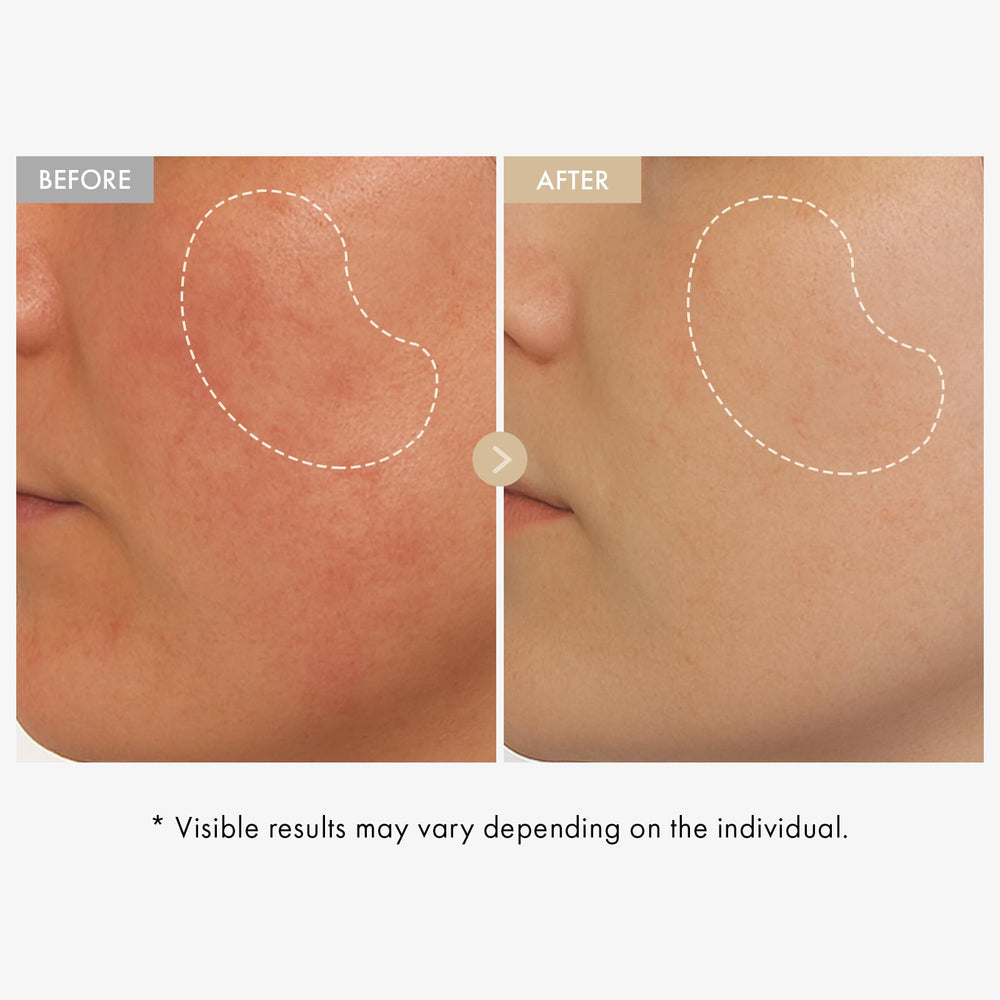 TOSOWOONG serum dropper dispensing texture, demonstrates fast absorbing hydration benefit