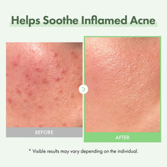 TOSOWOONG serum droplet on fingertip demonstrating easy dosing benefit