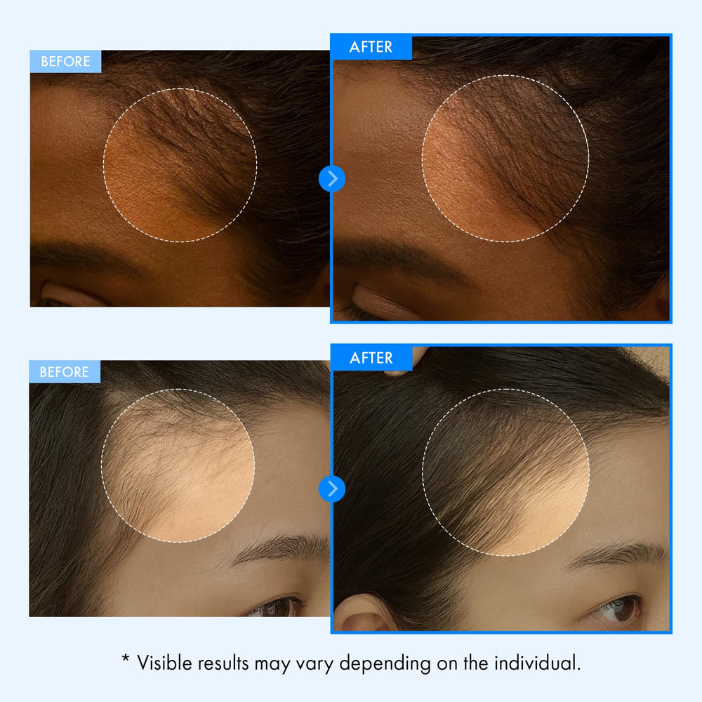 TOSOWOONG watery serum texture on hand demonstrating fast absorption