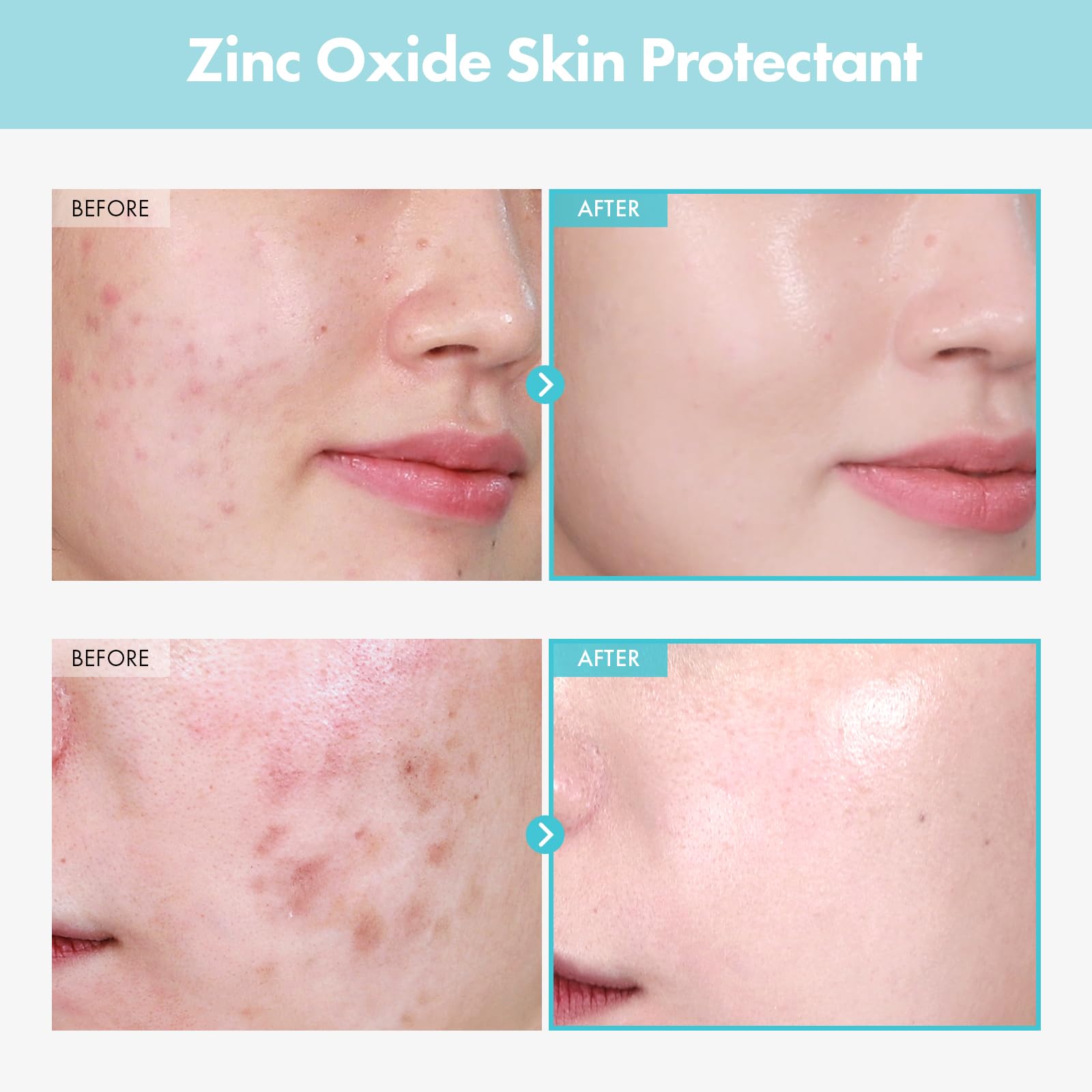 TOSOWOONG SOS Repair CICA Cream texture close-up shows creamy, fast-absorbing formula.