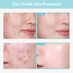 TOSOWOONG SOS Repair CICA Cream texture close-up shows creamy, fast-absorbing formula.