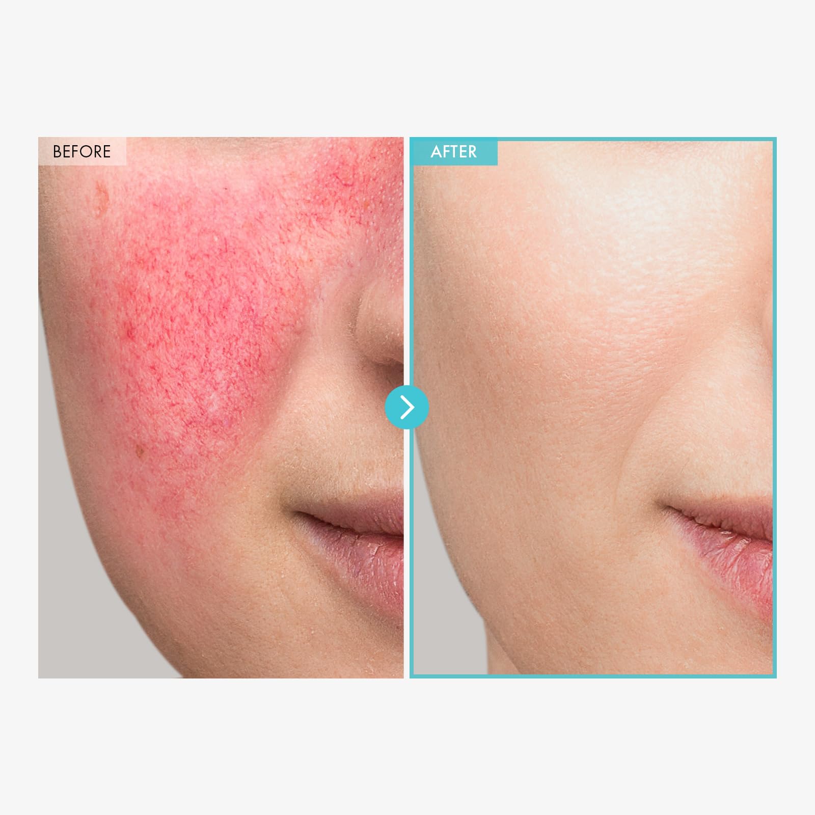 TOSOWOONG SOS Repair CICA Cream zinc oxide detail highlights protective skin care.