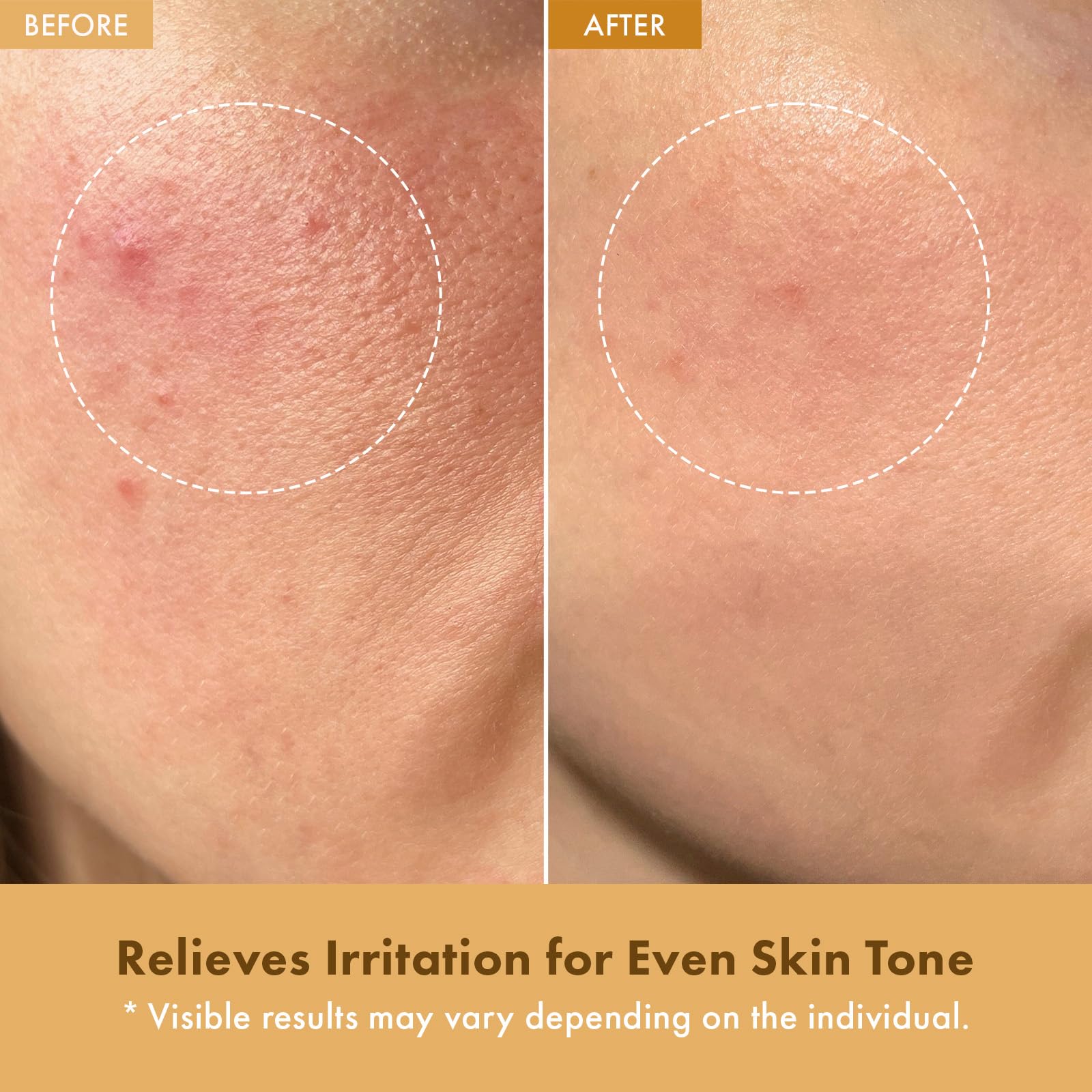TOSOWOONG cream texture close-up demonstrating lightweight, non-greasy absorption
