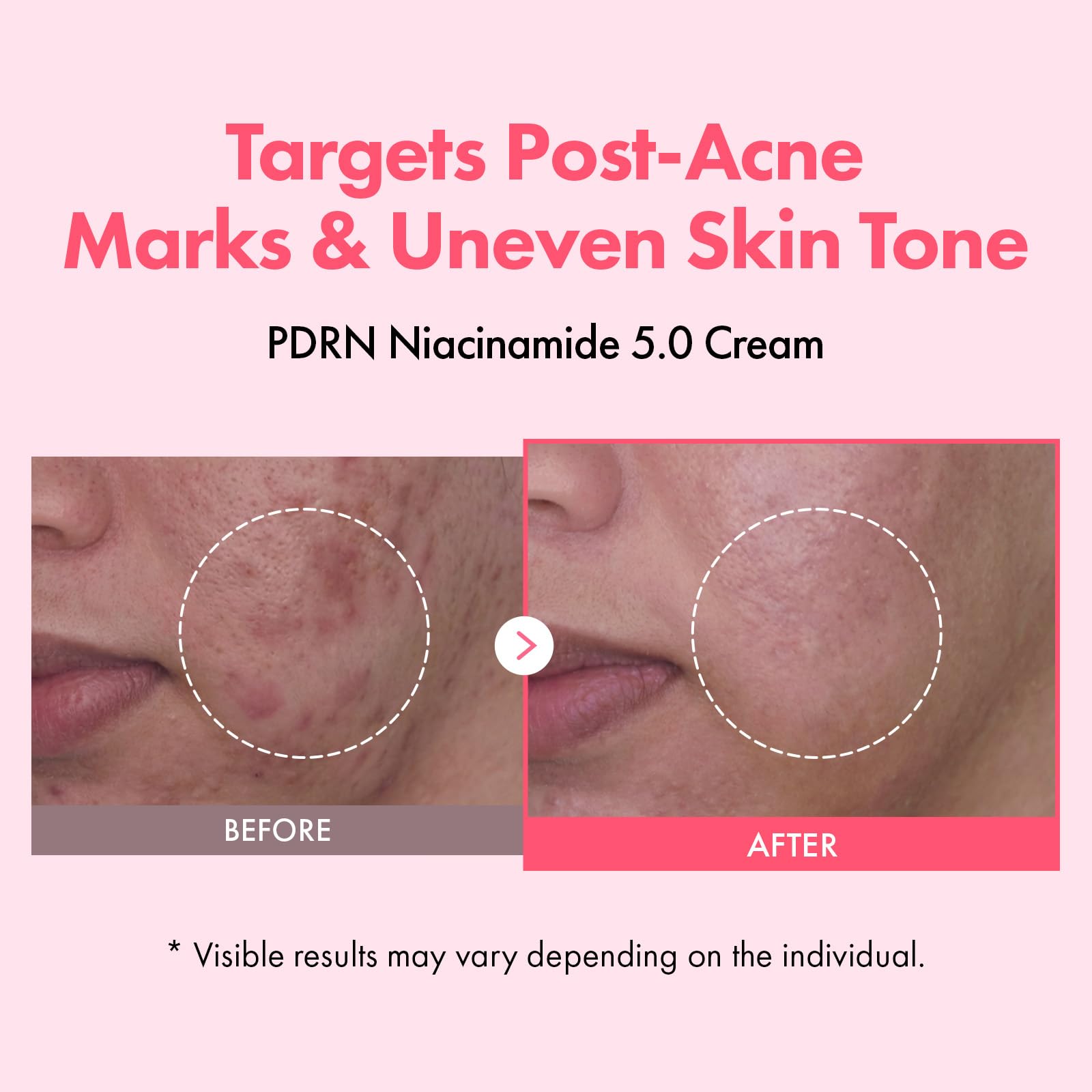TOSOWOONG texture close-up cream swipe revealing lightweight hydration benefit