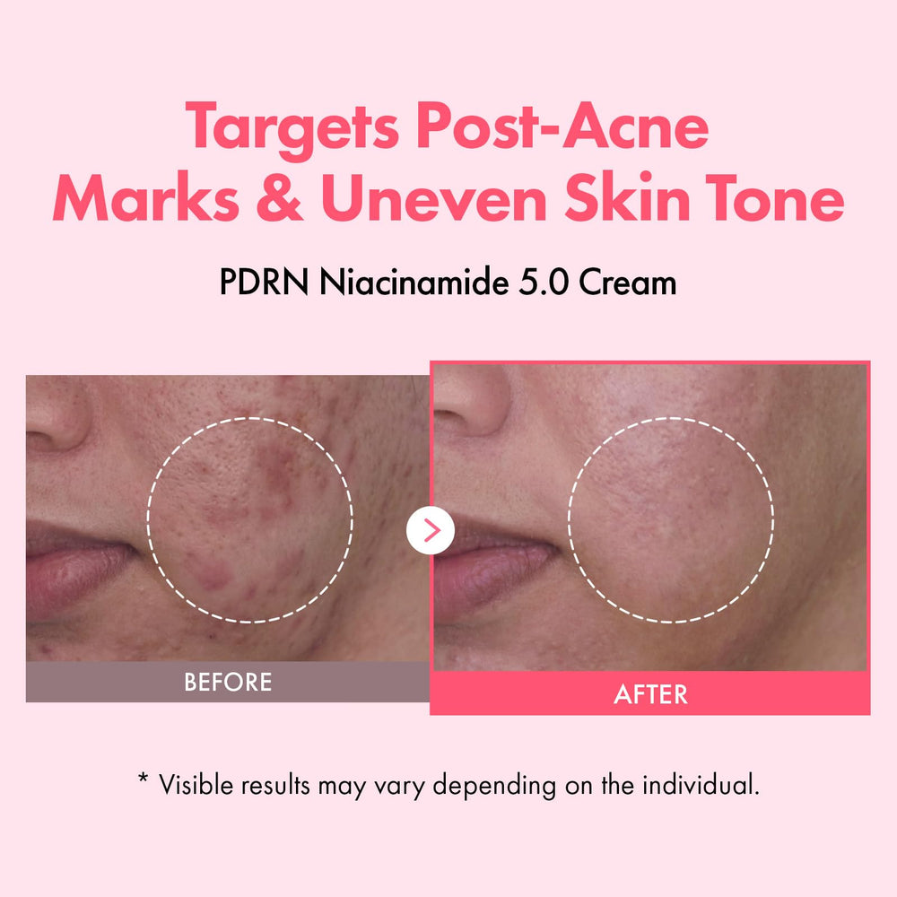 TOSOWOONG texture close-up cream swipe revealing lightweight hydration benefit