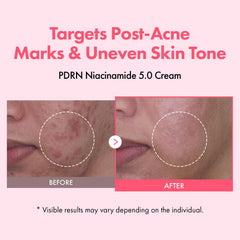 TOSOWOONG texture close-up cream swipe revealing lightweight hydration benefit