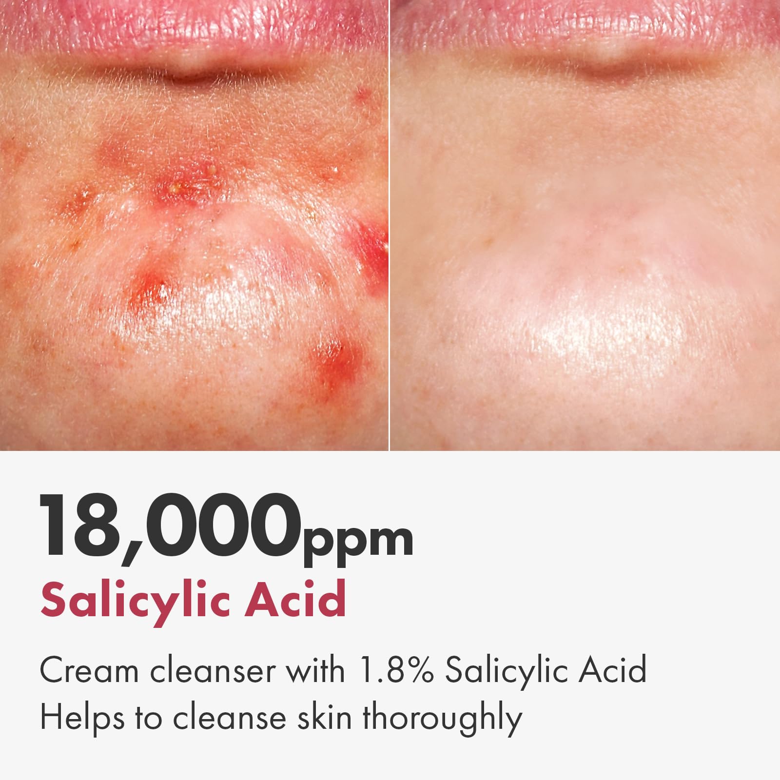 TOSOWOONG foam lather texture demonstrating gentle cleansing