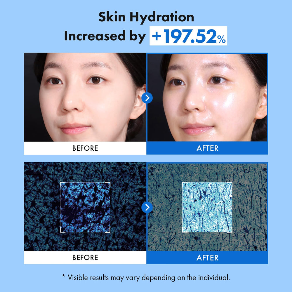 TOSOWOONG watery texture puddle illustrating fast-absorbing hydration