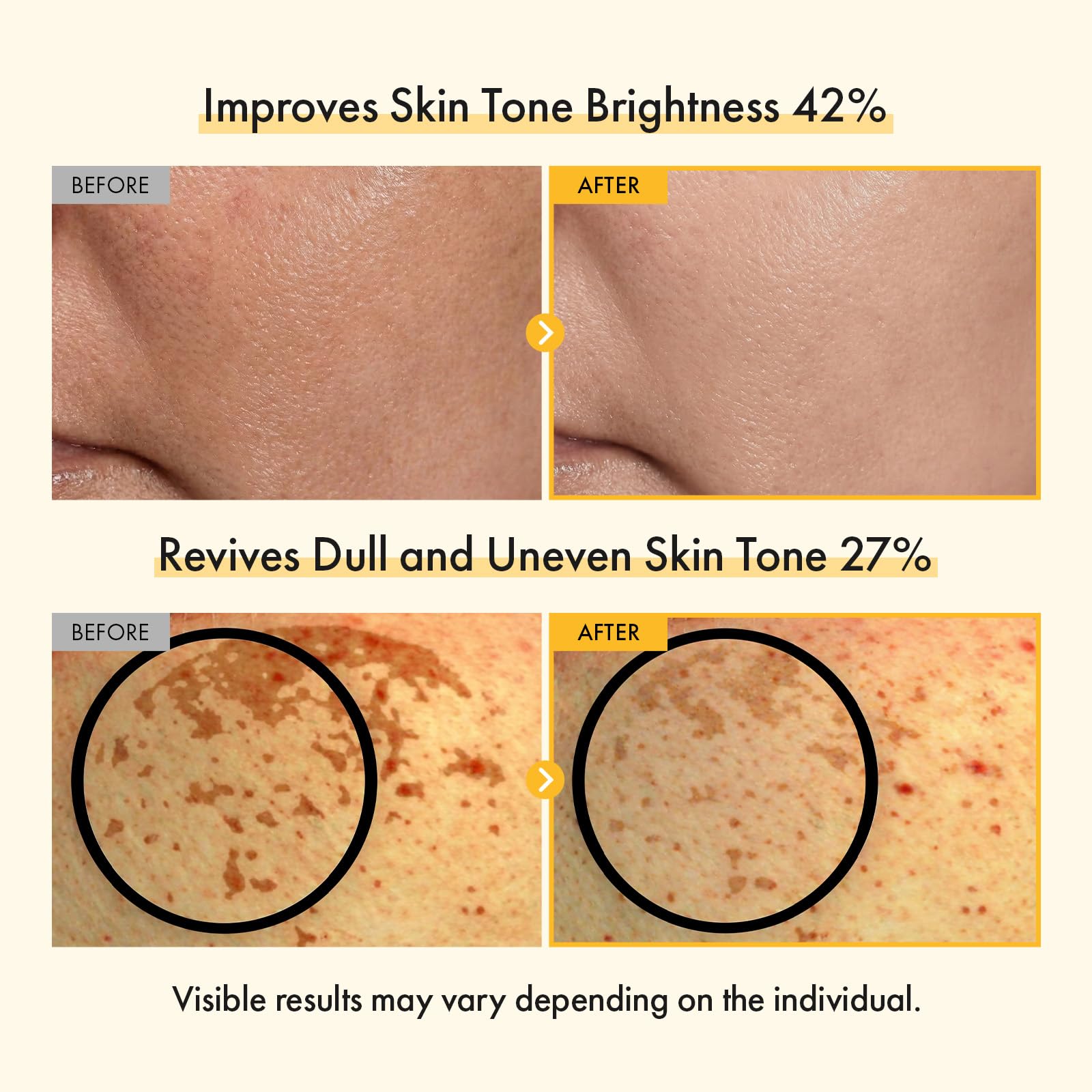 TOSOWOONG creamy texture spread showing quick-absorbing, non-greasy finish