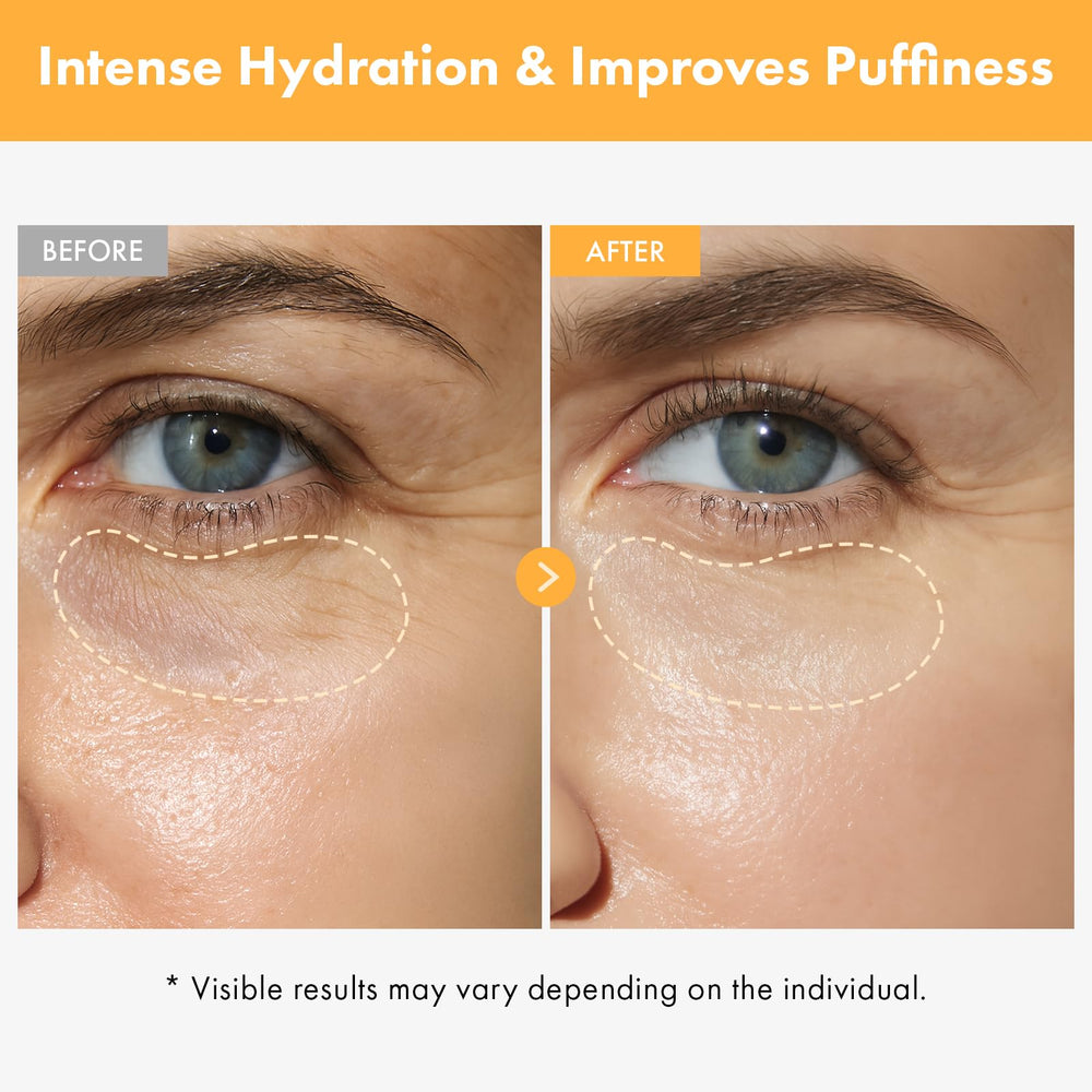 TOSOWOONG VITA Clinic under-eye hydration helps refresh tired-looking eyes.