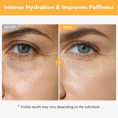 TOSOWOONG VITA Clinic under-eye hydration helps refresh tired-looking eyes.