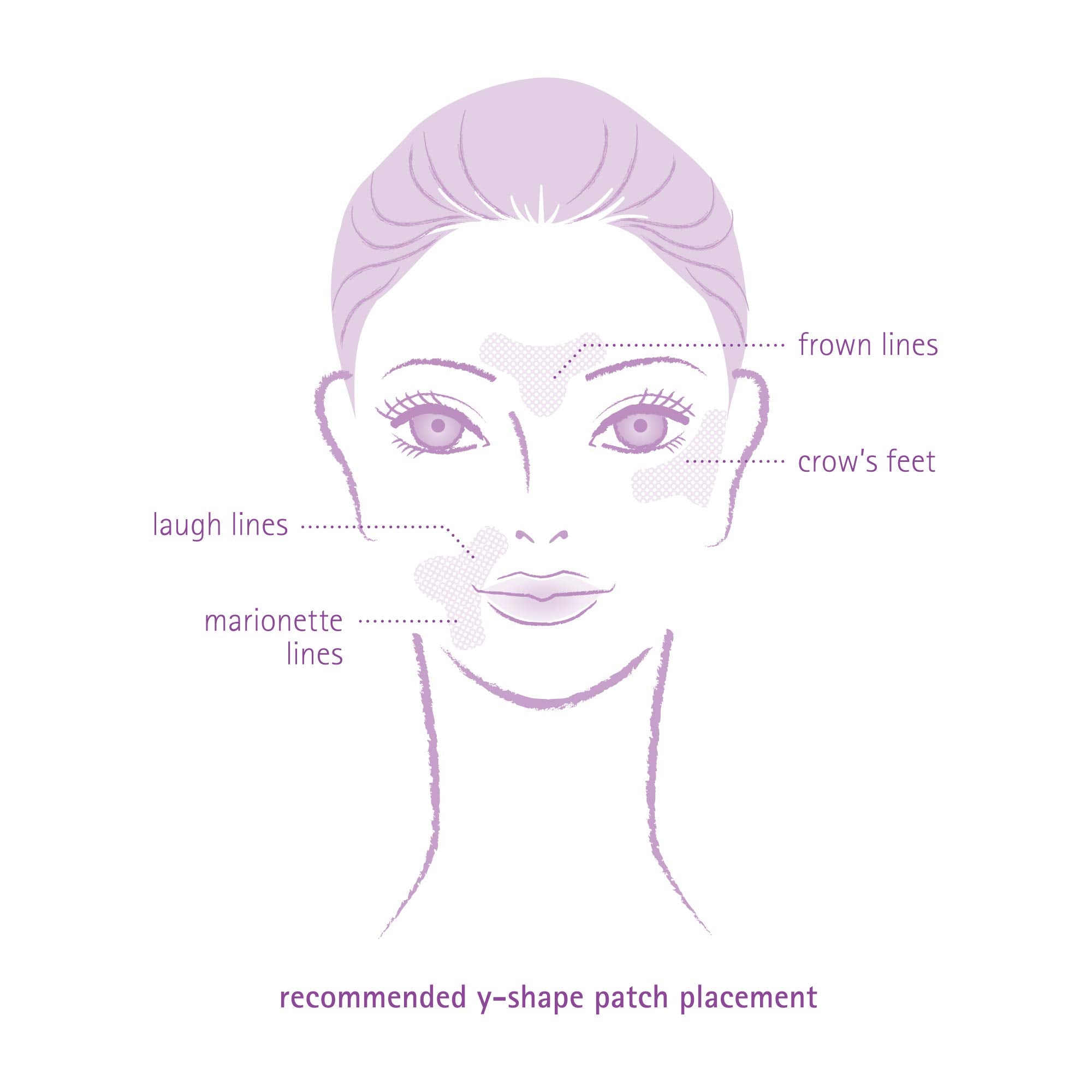 Toute Nuit Wrinkle Patches on skin closeup shows transparent, comfortable wear
