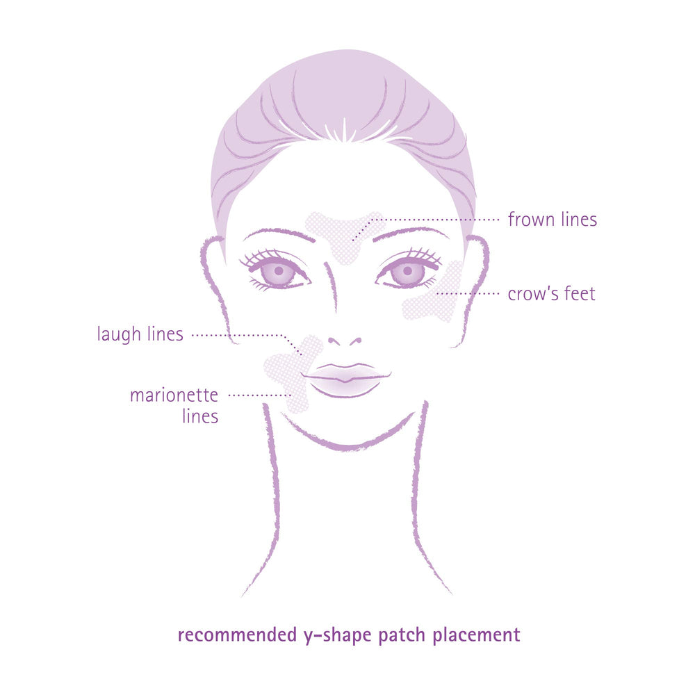 Toute Nuit Wrinkle Patches on skin closeup shows transparent, comfortable wear