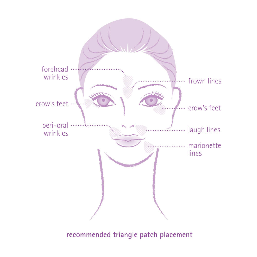 Toute Nuit triangle patches on lip wrinkles may smooth perioral lines for a subtle appearance.