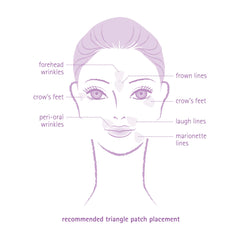 Toute Nuit triangle patches on lip wrinkles may smooth perioral lines for a subtle appearance.