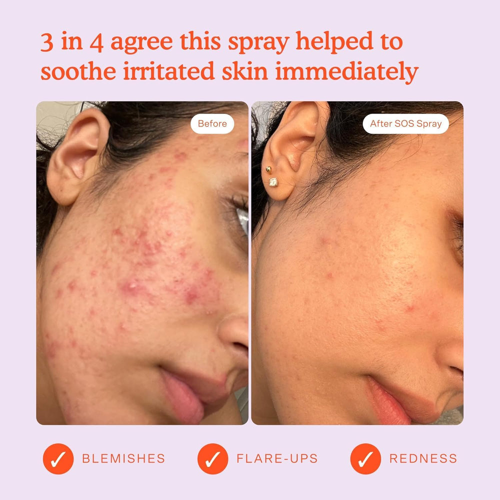 Tower 28 SOS Daily Rescue Spray applying on face delivers a soothing mist