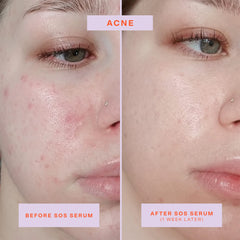 Tower 28 SOS Serum outer box highlighting gentle redness relief