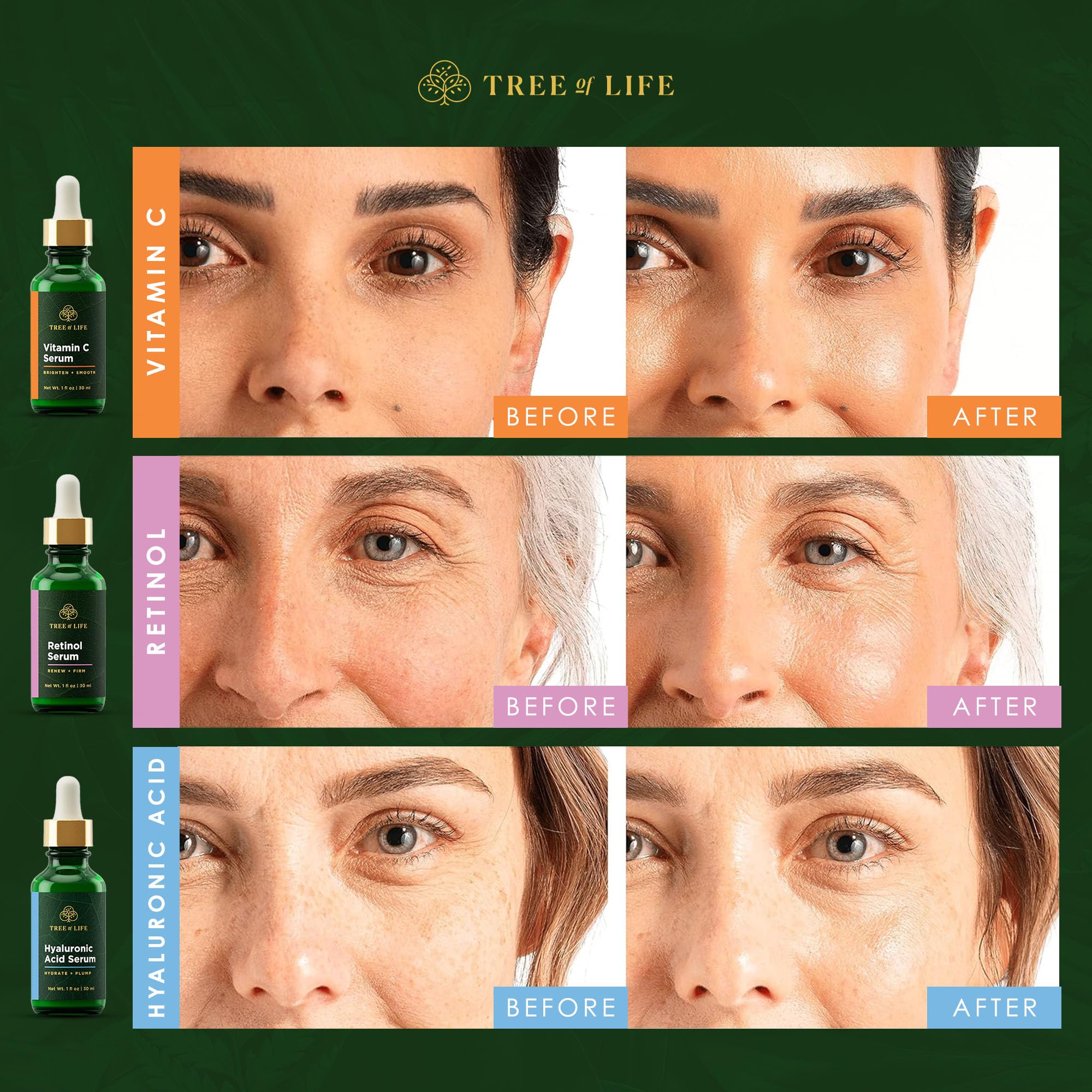 Tree of Life Beauty dry and sensitive skin care packaging close-up
