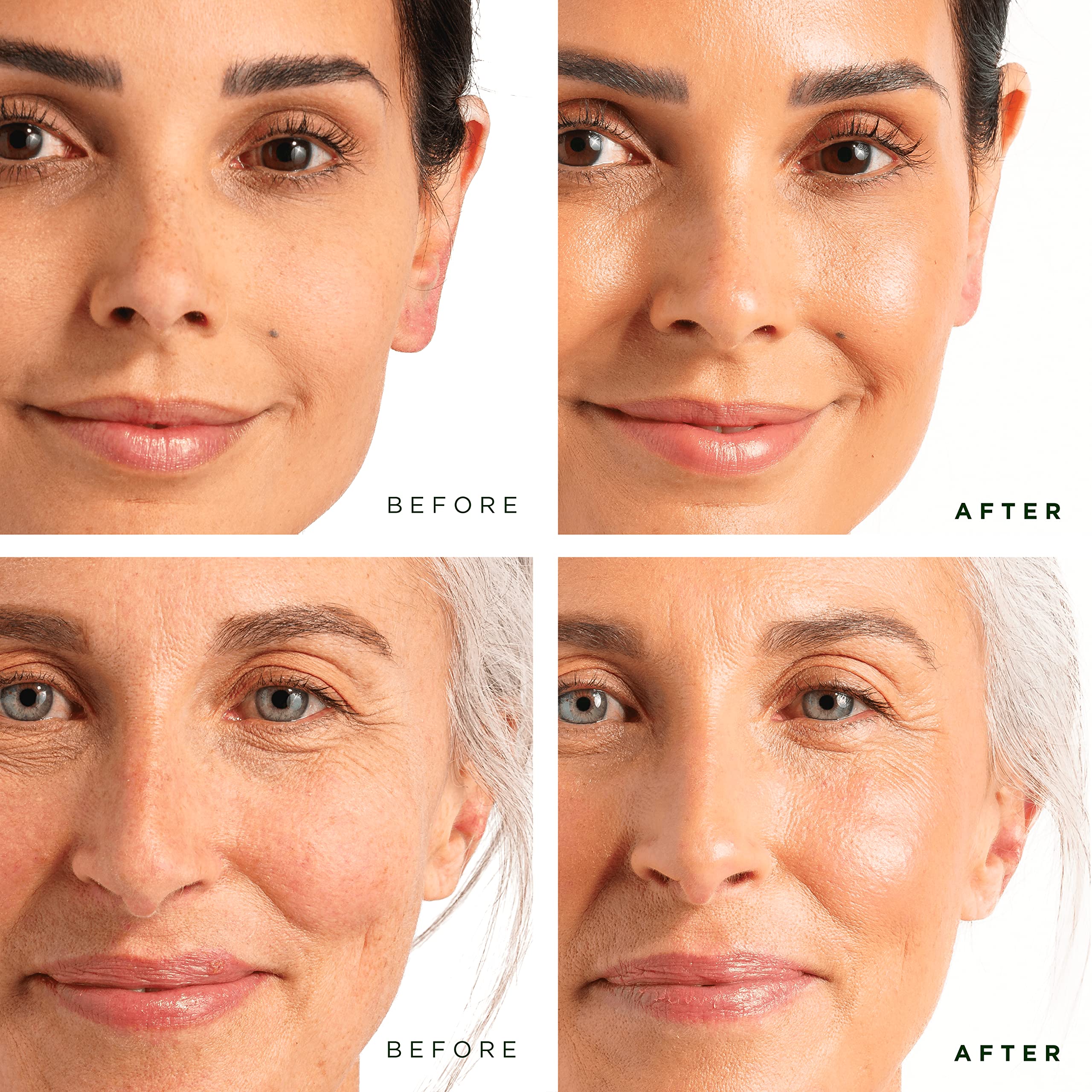 Tree of Life Beauty Niacinamide serum bottle helps minimize pores and even tone.