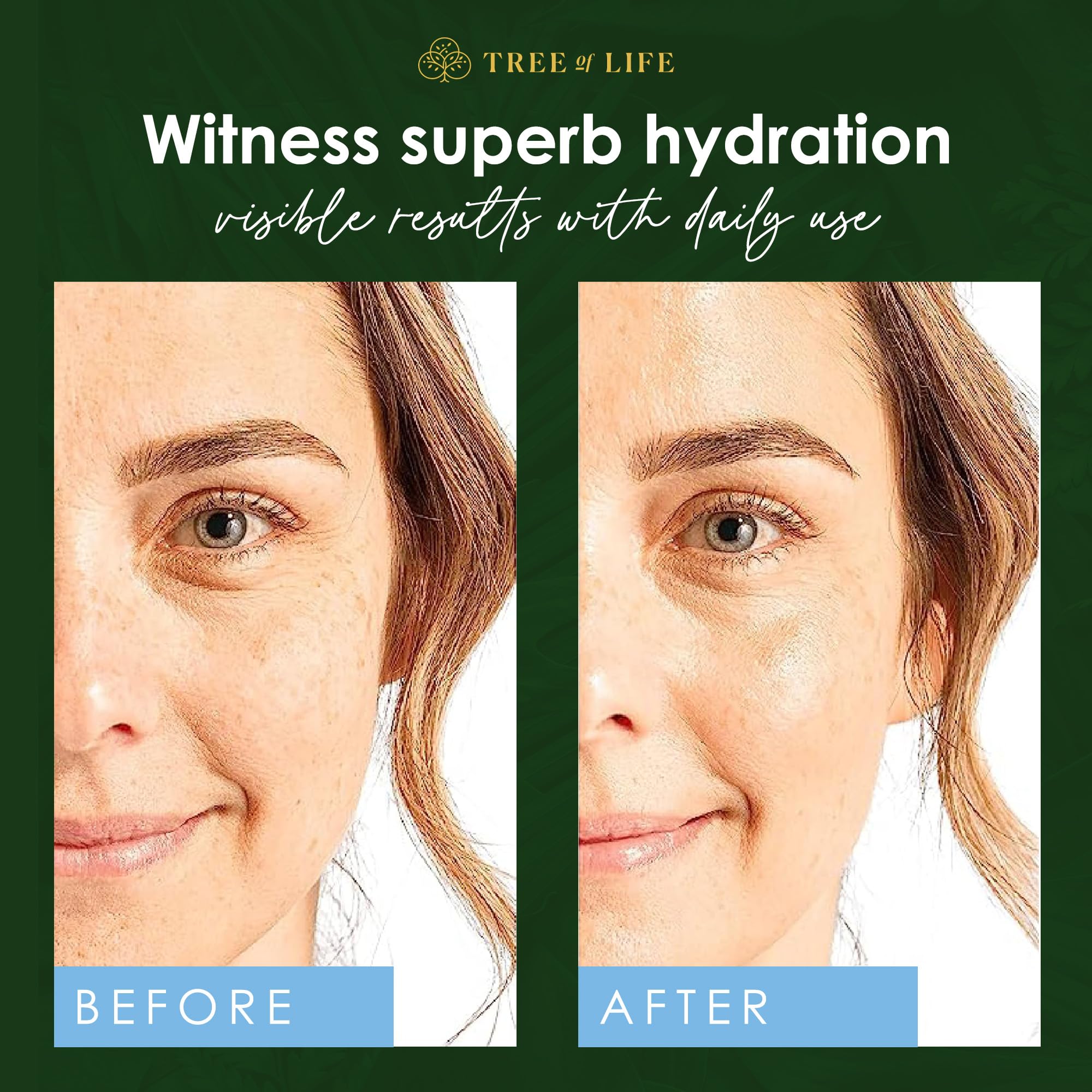 Luminous skin texture after using Tree of Life Beauty serum highlighting improved elasticity.
