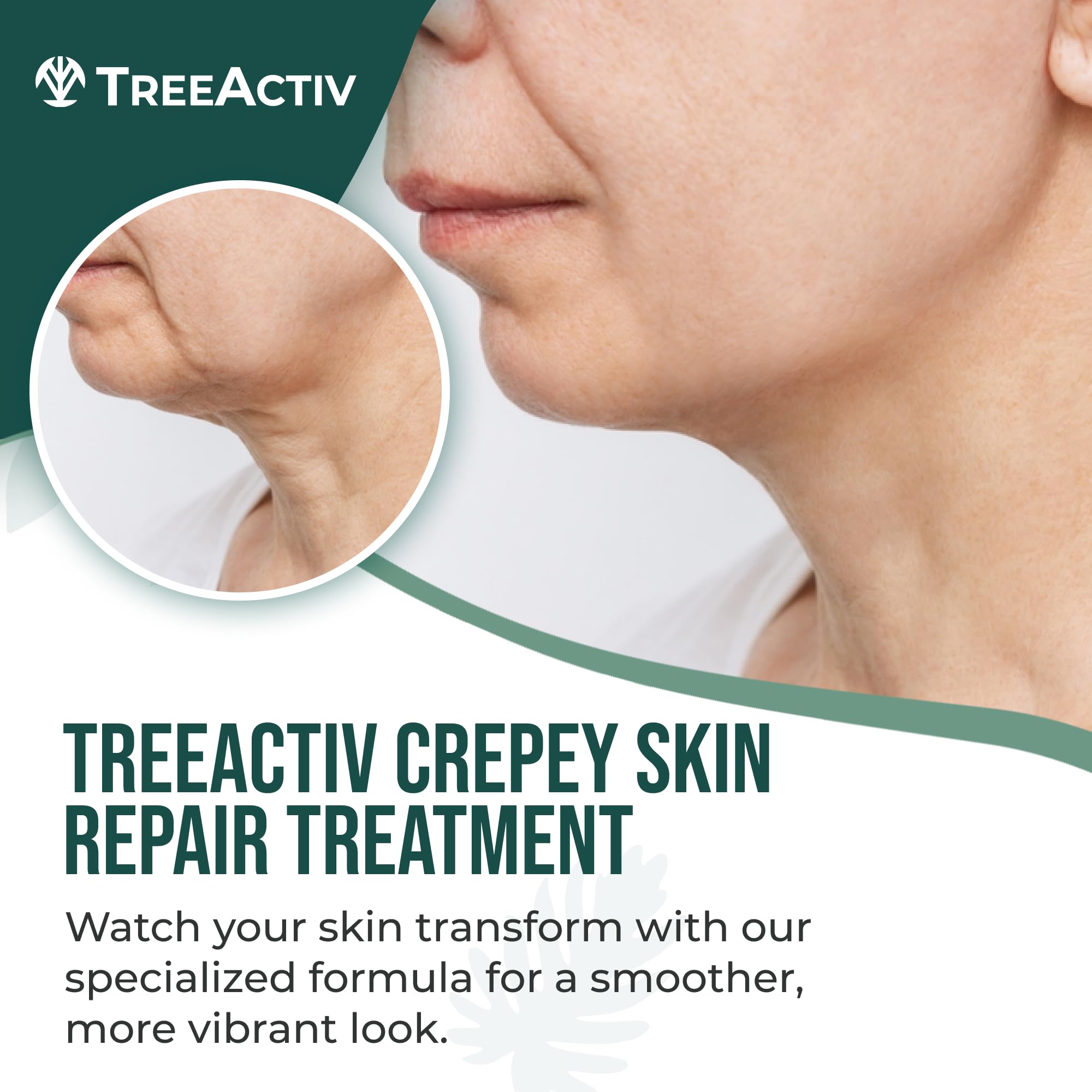 TreeActiv Crepey Skin Repair Cream being massaged into skin for texture refinement