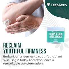 TreeActiv Crepey Skin Repair Cream bottle closeup—hyaluronic acid for moisture retention.