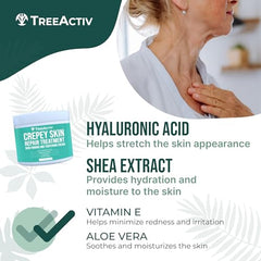 TreeActiv Crepey Skin Repair Cream texture swatch—refined skin texture and smoother appearance.