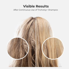 Tricholoyplus oil-control cleanse on scalp showing fresh, residue-free cleanse