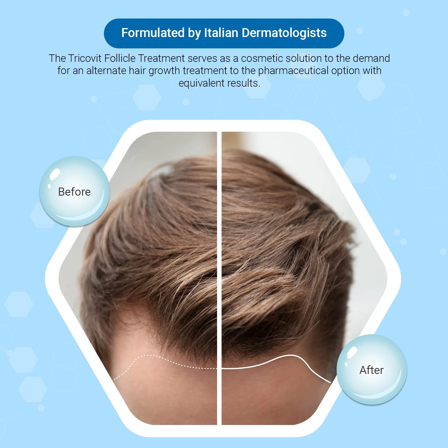 Tricovit Hair Growth Shampoo label highlights dermatologist-formulated care.