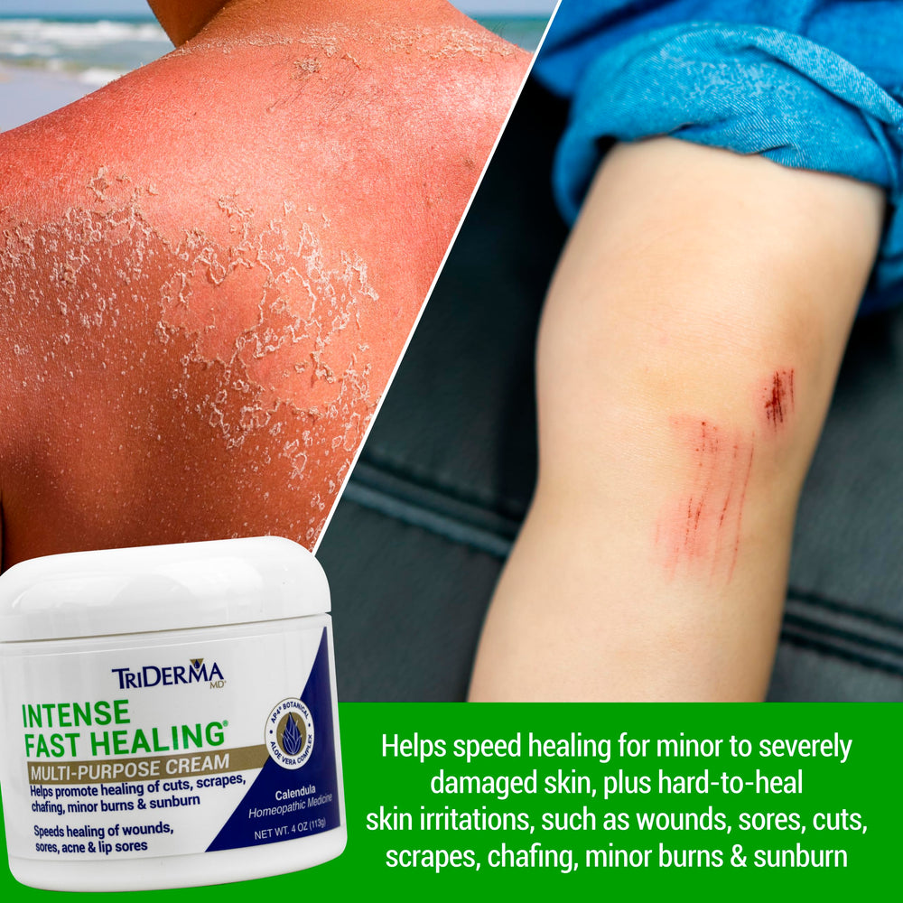 TriDerma Intense Fast Healing Cream AP4 Aloe Complex illustration highlights soothing skin support