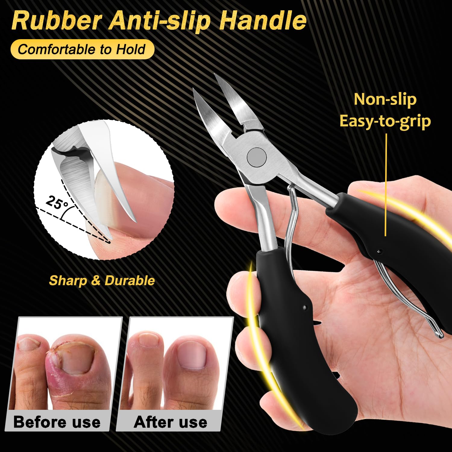 Trimlyx toenail file included for smoothing edges post trim