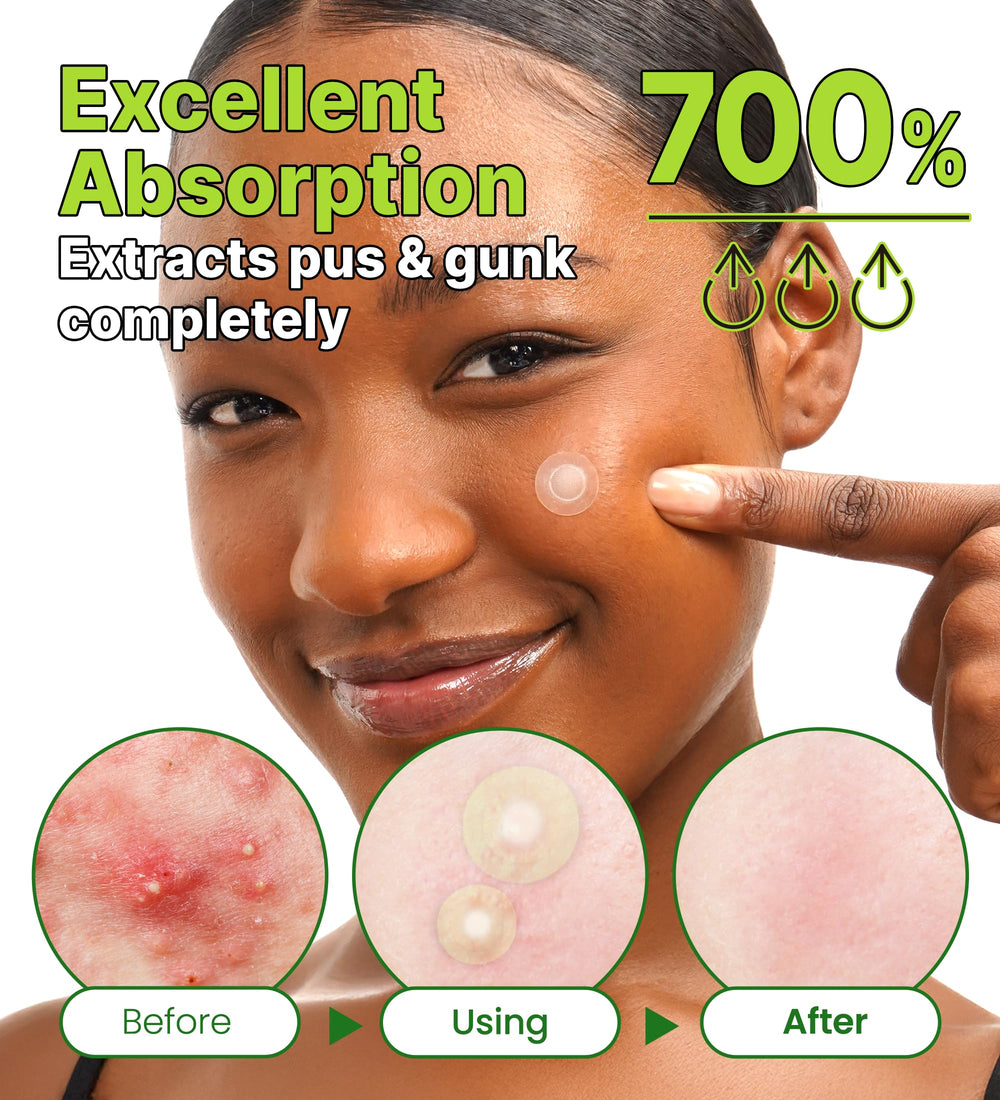 Troubless Invisible Plus Red Correct adhesion closeup with breathable wear